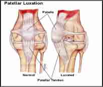 LUXATING PATELLA